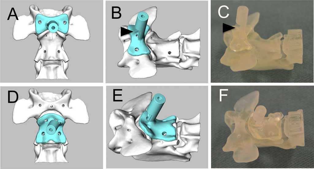 Impresión 3D para tratar la subluxación atlantoaxial en perros de raza pequeña