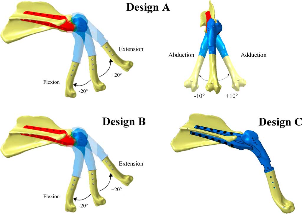 Prótesis para perros con osteosarcoma.