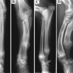 Condrodisplasia en dálmatas, últimos hallazgos.